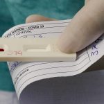 Botucatu tem aumento de 70% de casos de Covid em comparação com a semana anterior