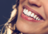 A importância da estética dos dentes para um sorriso bonito