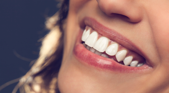 A importância da estética dos dentes para um sorriso bonito