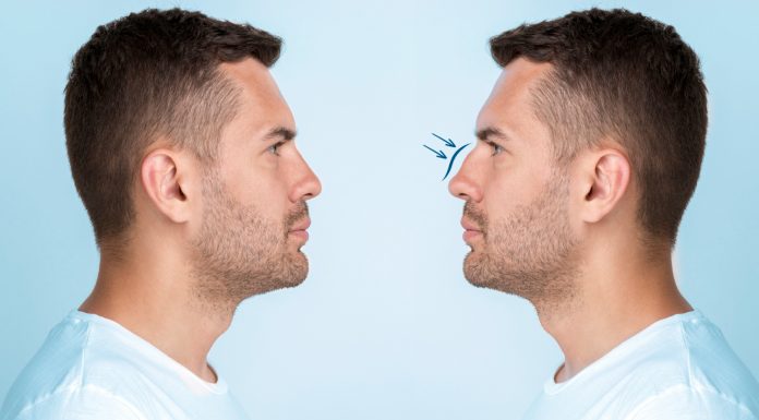 Rinoplastia está entre procedimentos mais buscado por homens
