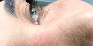 O que é camuflagem de olheiras e quais seus riscos? O que é camuflagem de olheiras e quais seus riscos?