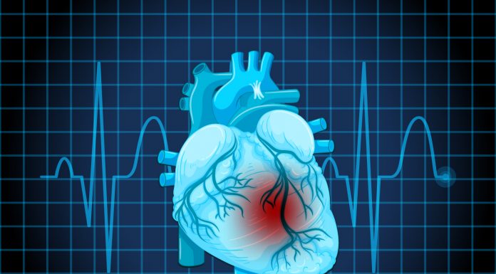Cardiologista orienta sobre cuidados após o infarto