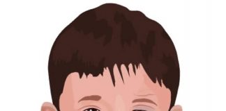 O que é paralisia facial congênita e qual o tratamento?