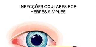 Infecções oculares por Herpes Simples têm tratamento