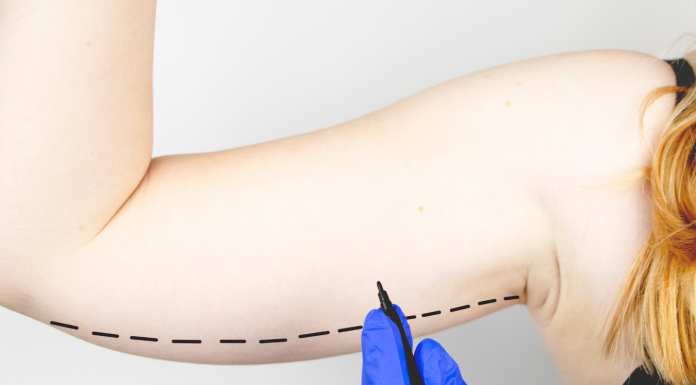 Lipoaspiração é a cirurgia plástica mais comum no Brasil, segundo pesquisa