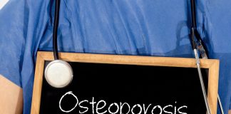 Redução de estrogênio na menopausa traz risco de osteoporose Redução de estrogênio na menopausa traz risco de osteoporose