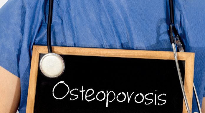 Redução de estrogênio na menopausa traz risco de osteoporose