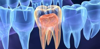 Endodontia ganha espaço na saúde pública nacional Endodontia ganha espaço na saúde pública nacional