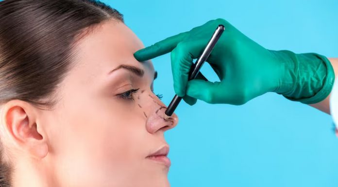 Melhora da autoestima é um dos efeitos da rinoplastia, afirmam especialistas Melhora da autoestima é um dos efeitos da rinoplastia, afirmam especialistas