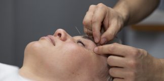 Mercado de trabalho para Acupunturistas avança no Brasil