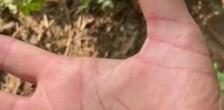 Vídeo de pescador com centenas de carrapatos viraliza Vídeo de pescador com centenas de carrapatos viraliza