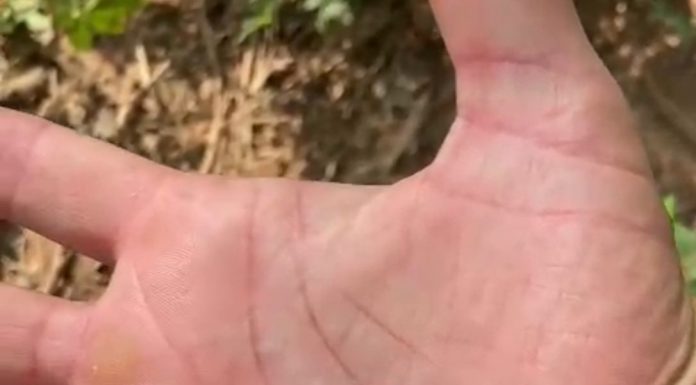 Vídeo de pescador com centenas de carrapatos viraliza Vídeo de pescador com centenas de carrapatos viraliza