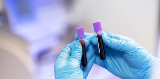 Aumento de casos de sífilis preocupa autoridades em Goiás Aumento de casos de sífilis preocupa autoridades em Goiás