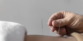 Acupuntura: SUS atende 1 milhão de pessoas anualmente