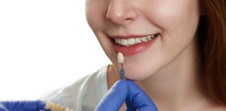 Facetas dentárias precisam de boa higiene bucal