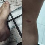 Botucatu: Pai espancado ao ser confundido com estuprador desabafa: ‘Justiça com as próprias mãos não existe’