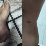 Botucatu: Polícia identifica suspeitos de agredir pai confundido com estuprador ao acompanhar filha