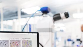 Webinar abordará o uso de inteligência artificial na análise de amostras Webinar abordará o uso de inteligência artificial na análise de amostras