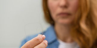 Transtorno mental causa queda dos cabelos