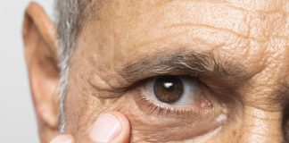 Catarata atinge cerca de 65,2 milhões de pessoas no mundo Catarata atinge cerca de 65,2 milhões de pessoas no mundo