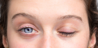 Diagnóstico contribui para o tratamento da paralisia facial