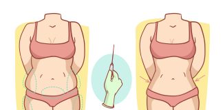 Lipoaspiração é a cirurgia plástica mais realizada no Brasil