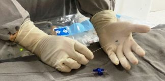 Medplus comemora o primeiro cateterismo em recém nascido pelo SUS no Tocantins