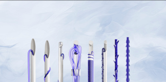 Fios de PDO: tratamento ganha espaço na estética Fios de PDO: tratamento ganha espaço na estética