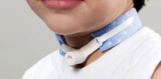 Crianças com traqueostomia exigem cuidados especiais