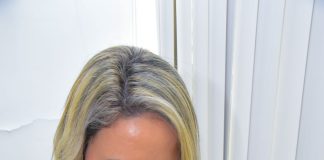 Preenchimento labial pode harmonizar rosto de forma natural