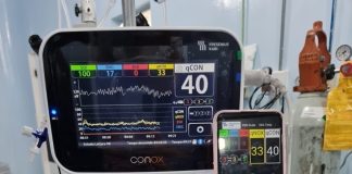 Chega ao Brasil novo aparelho de monitoramento de anestesia