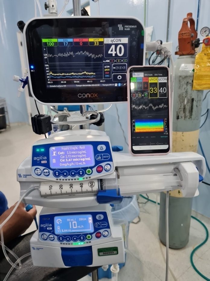 Chega ao Brasil novo aparelho de monitoramento de anestesia Chega ao Brasil novo aparelho de monitoramento de anestesia