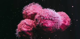 Terapia celular vira esperança para pacientes com câncer