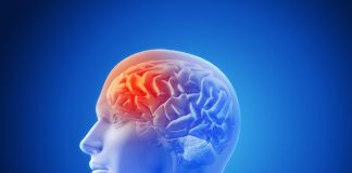 No Brasil, 343 vidas são perdidas por dia para o AVC