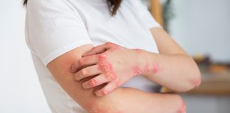 Sujeira acumulada em sofás pode desencadear alergias de pele