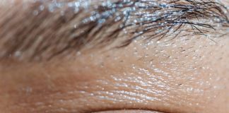 Campanha alerta sobre doença ocular relacionada à tireoide