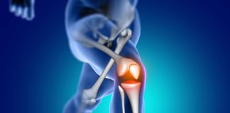 Lesões de joelho são mais propensas a ocorrer em determinados esportes