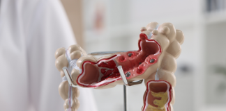 Adrian Bester lança curso on-line de modulação intestinal Adrian Bester lança curso on-line de modulação intestinal