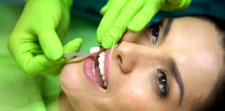 Facetas dentárias possibilitam um sorriso mais alinhado