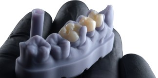 FGM Dental Group e dOne 3D apresentam a Voxelprint Ceramic