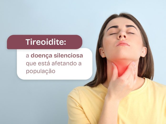 Tireoidite: doença silenciosa vem afetando a população Tireoidite: doença silenciosa vem afetando a população