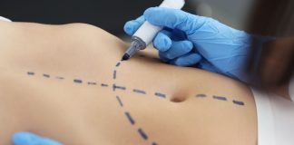 Resultados naturais são preferência em cirurgias plásticas