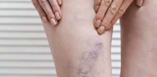 Divinópolis ganha novo centro de medicina vascular