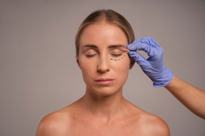 Blefaroplastia é o 3º procedimento mais realizado em 2023 Blefaroplastia é o 3º procedimento mais realizado em 2023