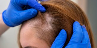 Tricologia auxilia no tratamento e cuidados capilares