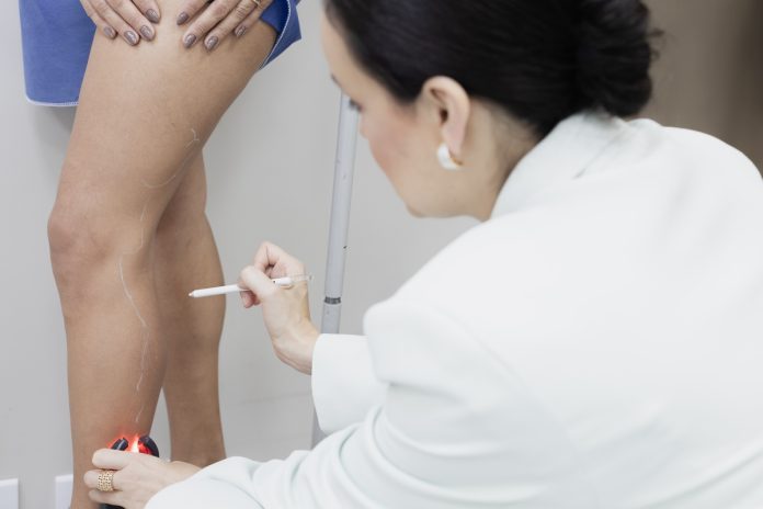 Cinco sinais que podem indicar problemas na circulação Cinco sinais que podem indicar problemas na circulação