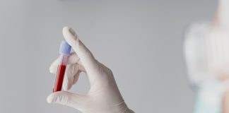 Transplante de medula óssea possibilita cura de 80 doenças Transplante de medula óssea possibilita cura de 80 doenças