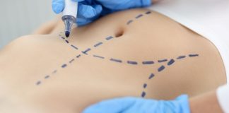 Cirurgia plástica: busca por resultados naturais é tendência Cirurgia plástica: busca por resultados naturais é tendência