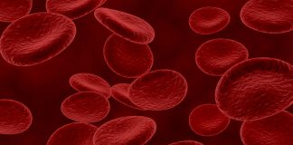 Mielodisplasia: doença silenciosa pode evoluir para leucemia