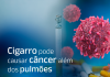 Cigarro pode causar câncer além dos pulmões Cigarro pode causar câncer além dos pulmões